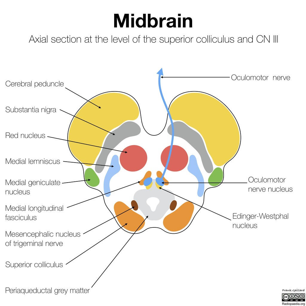 Oculomotor Nerve Localization